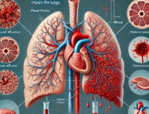 Mississippi Hospital Faces 3.1M Wrongful Death Verdict After Fatal Thoracentesis Error