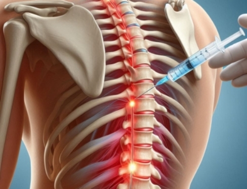 Medical Negligence Lawsuit: LA Physician Was Not Negligent in Administration of Spinal Injection